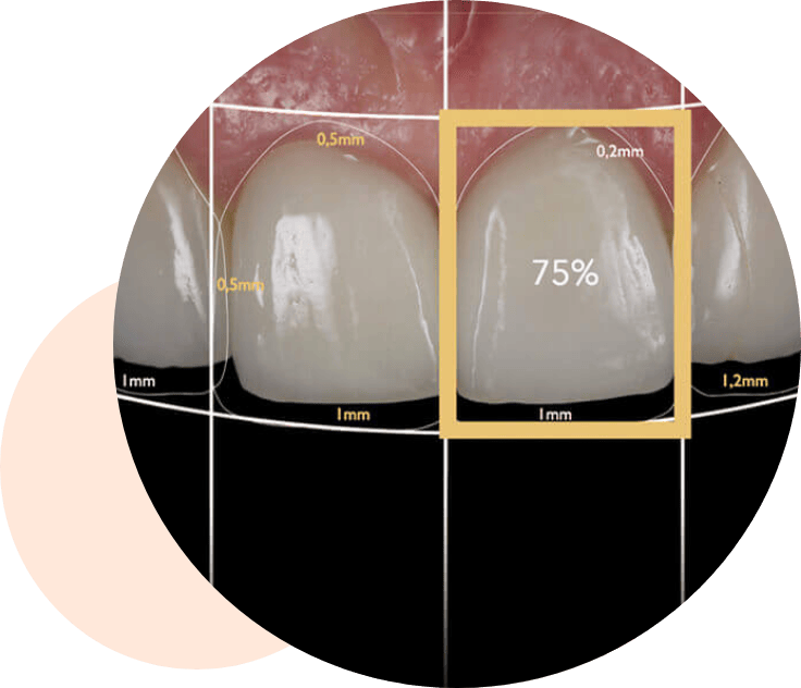 Kosmetiske behandlinger - Tandlægerne Gammel Strand - Component 2 – 1 - Kosmetiske behandlinger