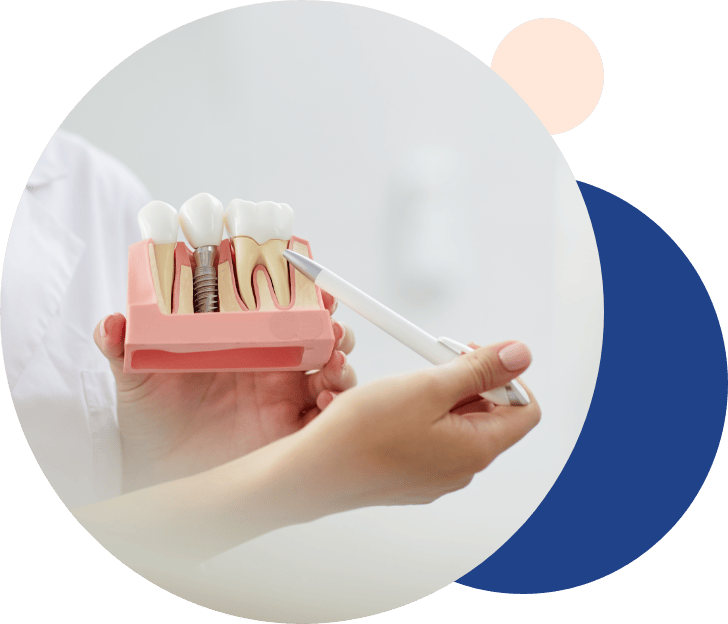 Implantat - Tandlægerne Gammel Strand - Group 22 - Implantat