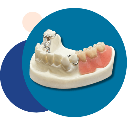 Prosthetic Teeth - Tandlægerne Gammel Strand - Design uden navn 6 - Prosthetic Teeth
